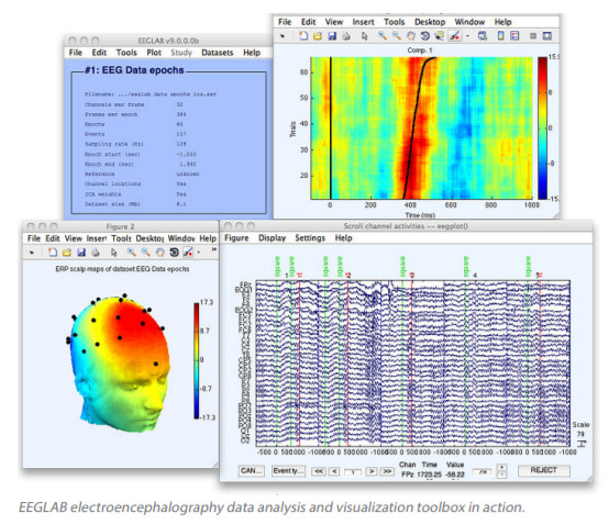 EEGLAB